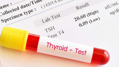 How much thyroid test cost