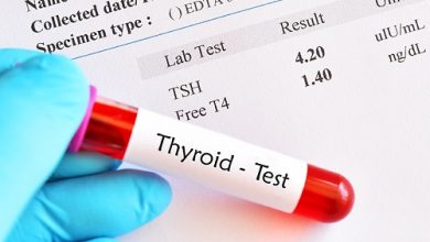 Thyroid Test price in egypt