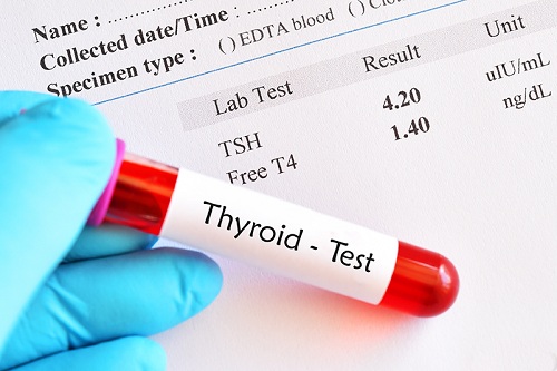 Thyroid Test price in egypt