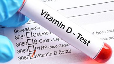 اسعار تحليل فيتامين د Vitamin D test price