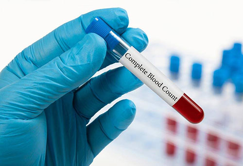  اسعار تحليل صورة الدم cbc test price in egypt