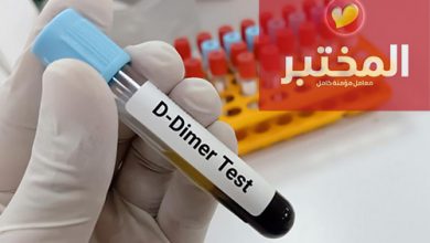 سعر تحليل D Dimer في المختبر