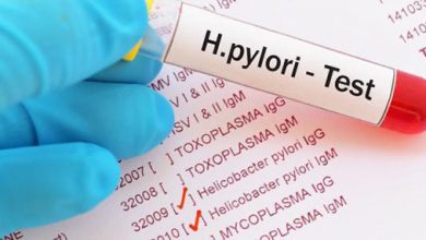 اسعار تحليل جرثومة المعدة Helicobacter Pylori H. Pylori Tests price