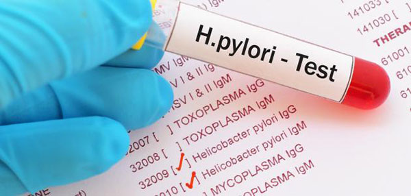 اسعار تحليل جرثومة المعدة Helicobacter Pylori H. Pylori Tests price