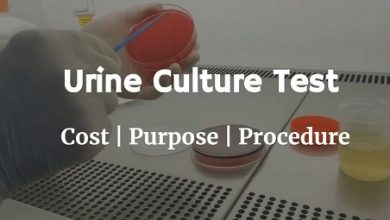 كم سعر تحليل مزرعة البول urine culture test price