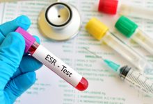 سعر تحليل ESR سرعة ترسيب الدم